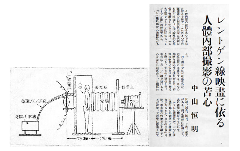 国産レントゲン撮影装置